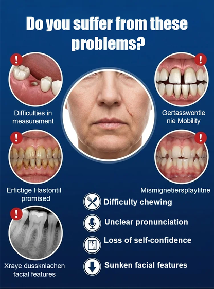 Strong Suction Full Denture for Confident Smile