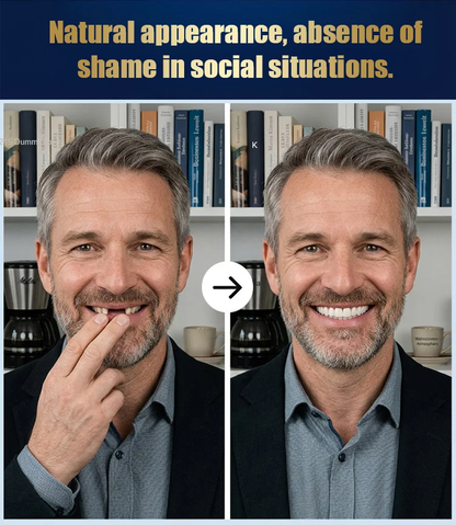 Strong Suction Full Denture for Confident Smile