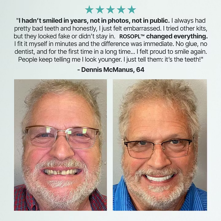 Cheeroll®Custom-Fit Dentures ⏰ ENDS TODAY • 70% OFF | Smile with Confidence